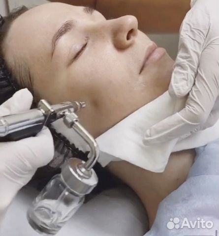 Косметологический аппарат Skindex